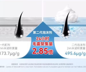 一梳头就“下雪”，脱发前兆？5款米诺地尔实测，尤其注意第1款