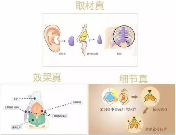 贴合最实际的需求，精细鼻部细节