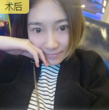 我发现眼睛朝上看的时候，下眼皮已经平了
