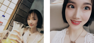 面部改变这般大，除了丰满就是年轻