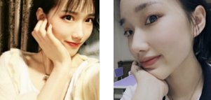 面部改变这般大，除了丰满就是年轻