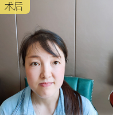 前两天说的那个眼睛的浮肿情况很快就平定下来了