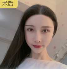 眼睛整体饱满且舒展