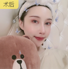 眼睛整体饱满且舒展