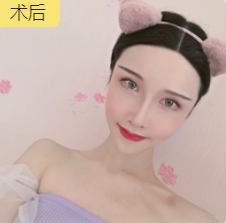 眼睛整体饱满且舒展