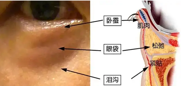 我们眼部发生结构性的变化部位较多