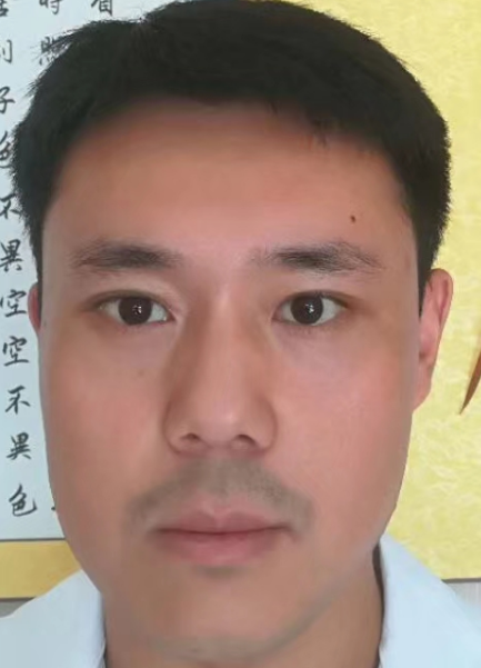眼睑很平整，再也没有难看的眼袋了!