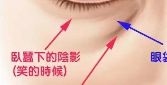 正在熬夜却不知“眼袋”的美眉们