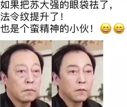 为了这个心灵鸡汤我也去做了眼袋