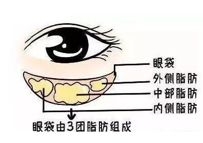 眼袋和不平整已经消失了，但是留下了浮肿