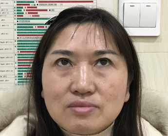 睑下的鼓包明显也是在预料之内的