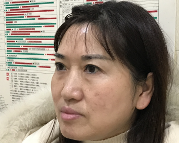 睑下的鼓包明显也是在预料之内的