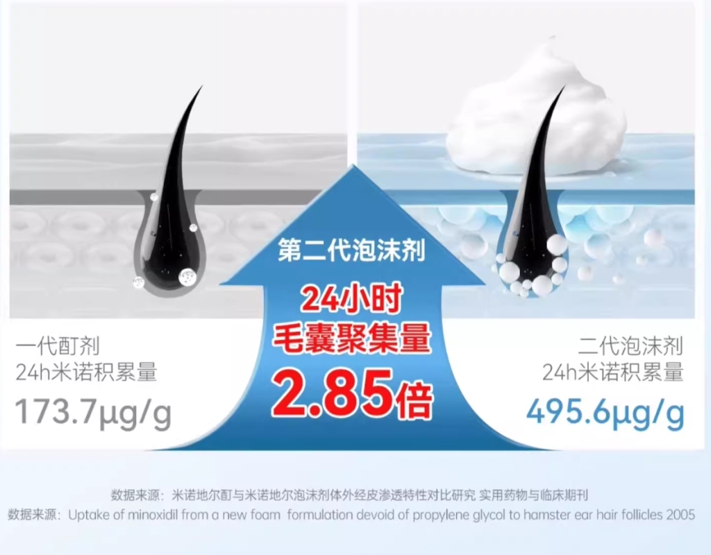 一梳头就“下雪”，脱发前兆？5款米诺地尔实测，尤其注意第1款