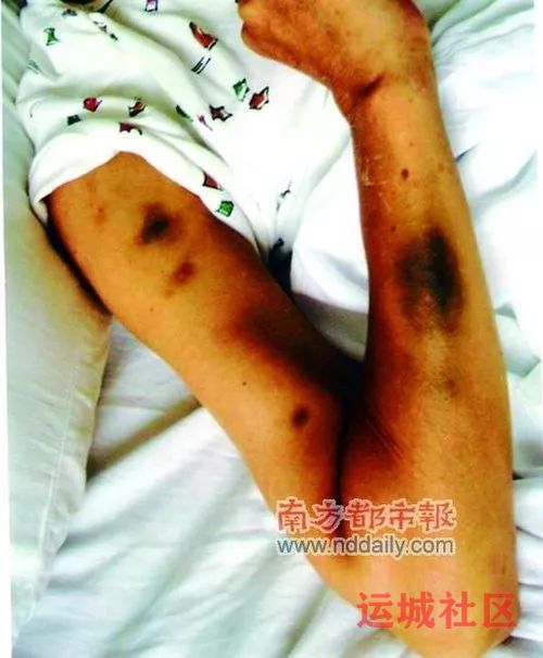 打错人了!省政法委领导夫人被6名 打错人了!省政法委领导夫人被6名